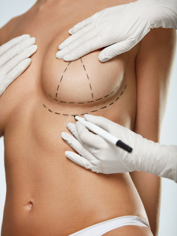 apokatastash-mastou-2 apokatastash mastou