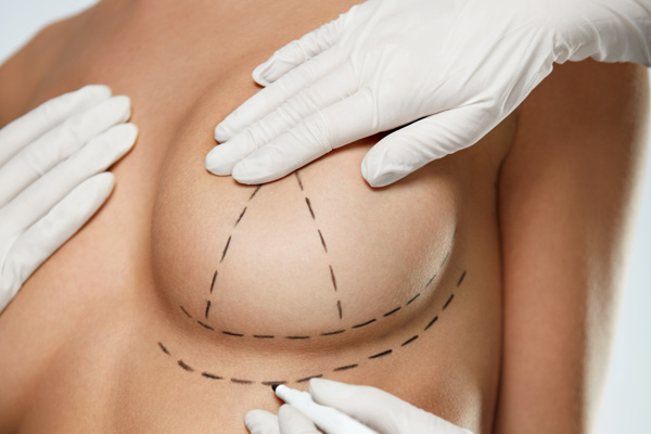 plastikh-sththos1 Plastikh Sththous